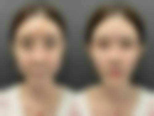 合肥维多利亚整形医院双眼皮医生：吴丽丽医生的魅力