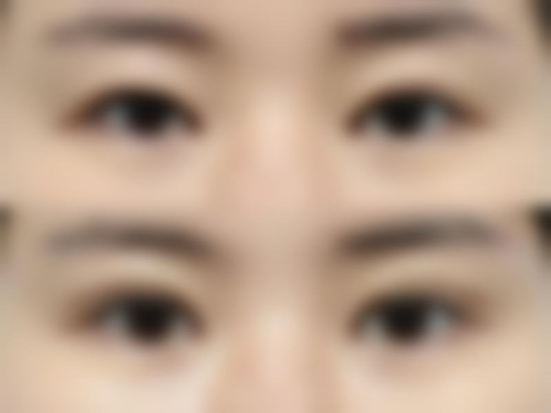 【双眼皮整形 + 5000】北京丰联丽格医疗美容门诊部医生实力