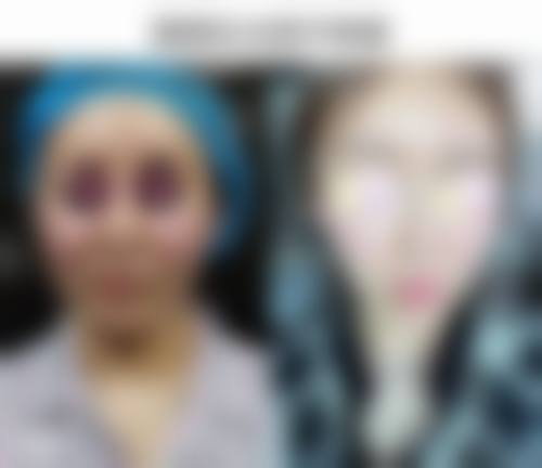 方海环医生做手术价格