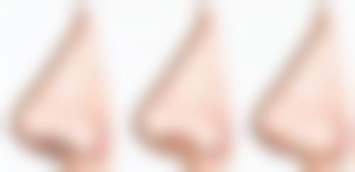 赵泽方医生：专精微整形医师口碑如何