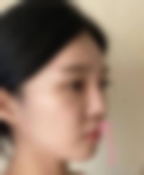 孔德记医生项目优势