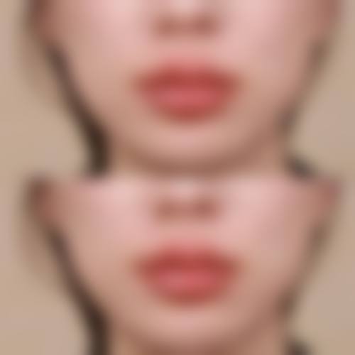 徐弈医生简介口碑如何