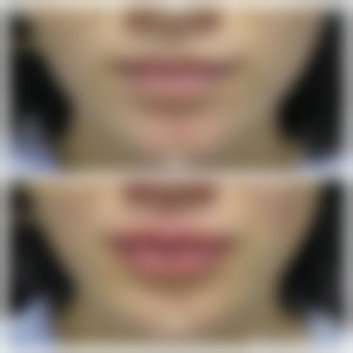 龙口恒悦整形医院口碑评价如何