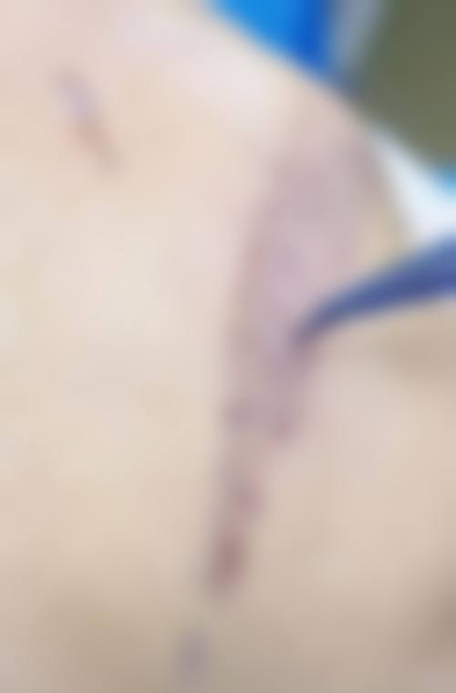 广州碧莲盛植发医院基本信息