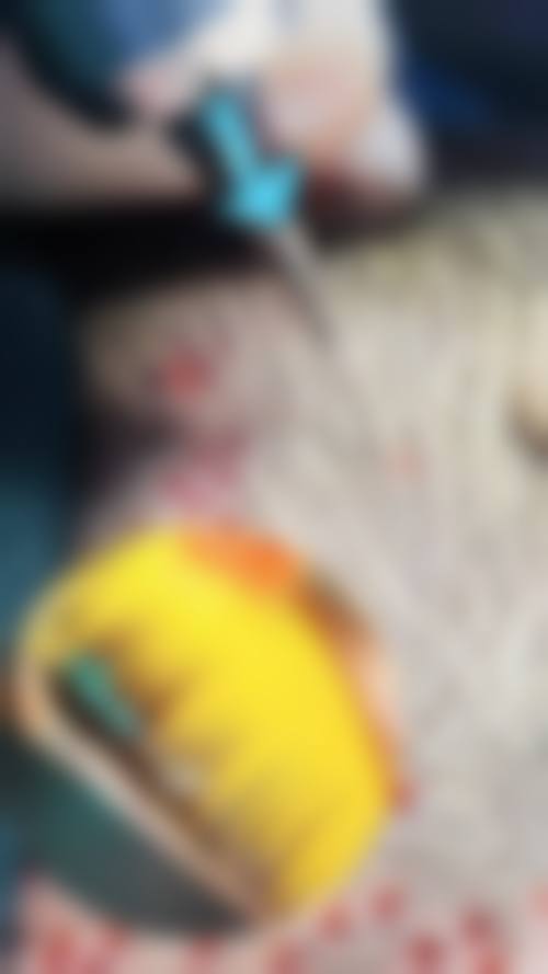 宋兆玲医生做手术价格