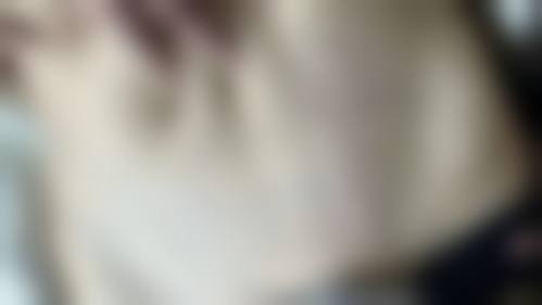 香港CLINICX微整形中 心口碑好不好？