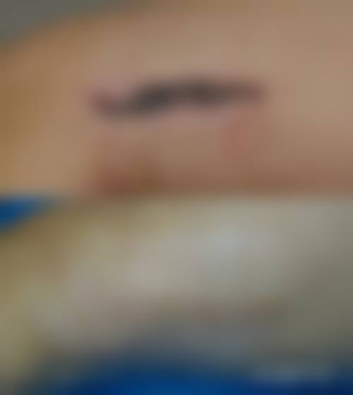 深圳宝安区人民医院烧伤整形科怎么样，口碑评价如何？