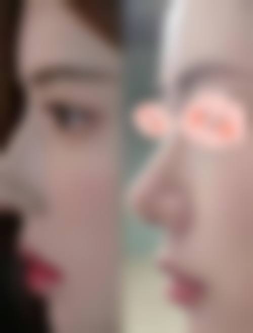 徐州华美医疗整形医院怎么样，口碑评价如何？