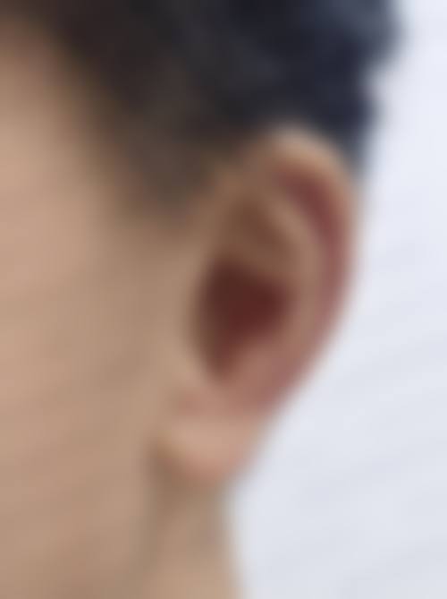 田地久医生简介做手术价格