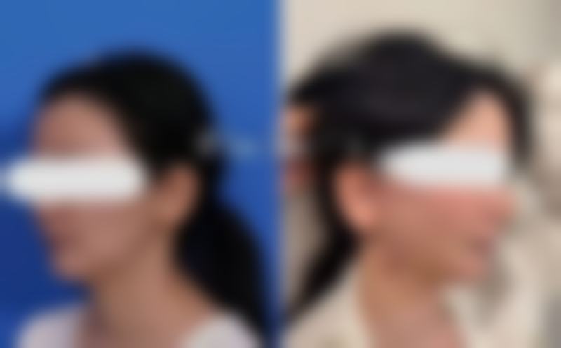 戚振医生简介做手术价格