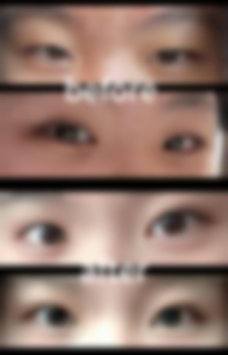 无锡张小熊医疗美容诊所更擅长什么手术