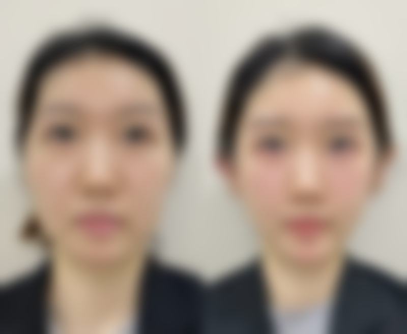 昆明医然心（思尔美）医疗美容诊所更擅长什么手术