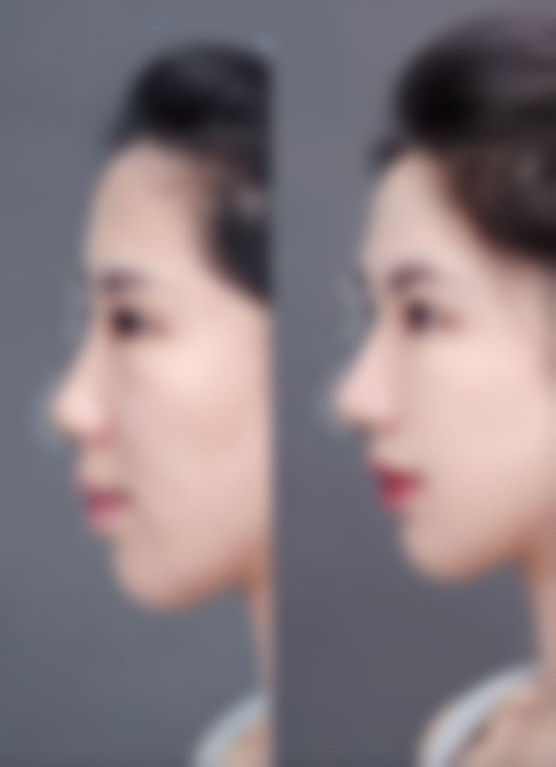 合肥庞博整形美容医院怎么样口碑好不好？附真实患者口碑评价