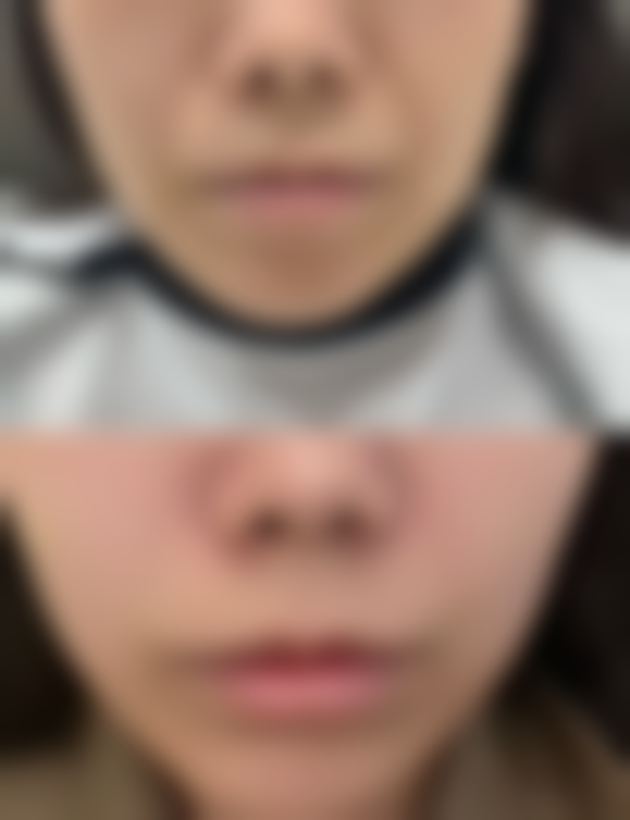 赵泽方医生：专精微整形医师项目优势