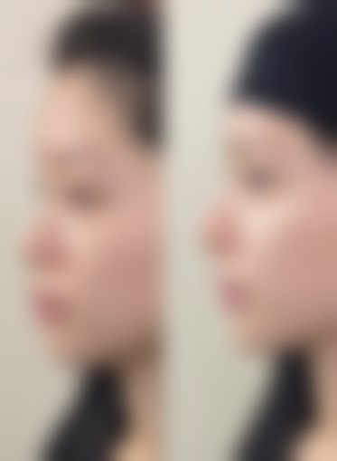 今井皮肤形成怎么样？口碑好不好