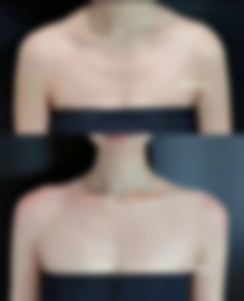 北海玮美整形医院怎么样——口碑好不好？附真实患者口碑评价