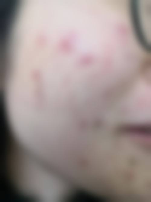 周洪超医生简介：怎么挂号