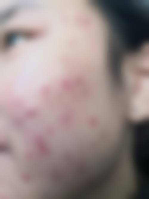 长沙零动整形医院口碑好不好？附真实患者口碑评价