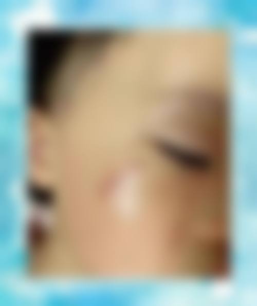 成都极致美妍整形医院口碑好不好？附真实患者口碑评价