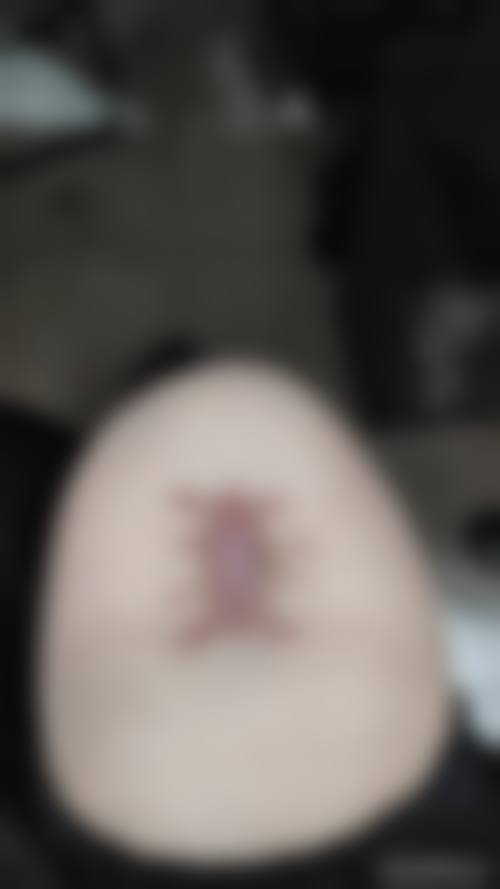 六、杭州蓝迈希望之星整形医院怎么样——地址及乘车路线