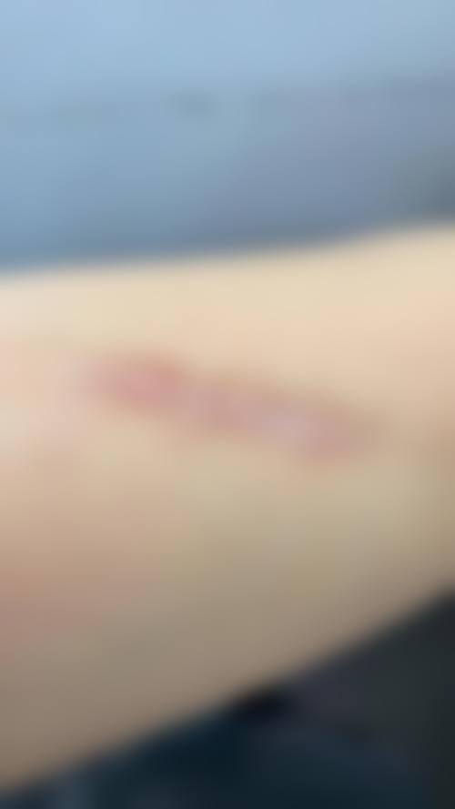 阳江恒大医疗美容诊所怎么样，评价