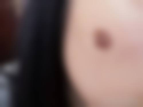 田龙元医生做手术价格是多少？