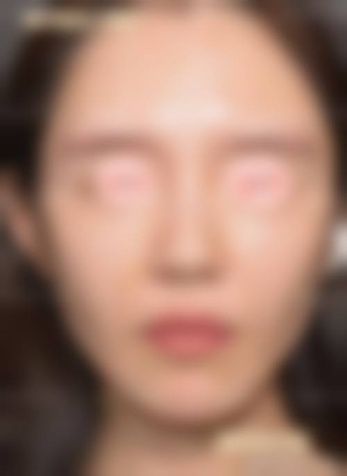 葛春颖医生项目优势有哪些