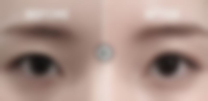 上海新极点整形医疗美容诊所怎么样，怎么挂号，地址在哪儿