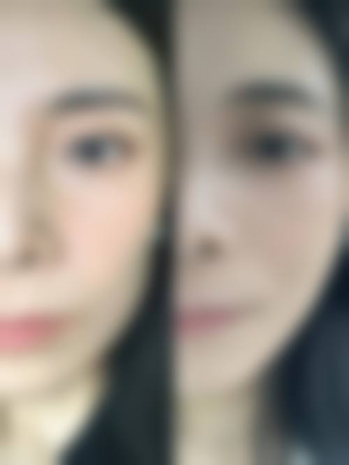 七、黄山百魅生医疗美容门诊部顾客实例