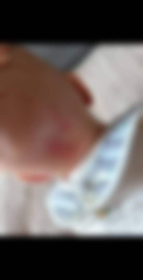 莆田振南整形医疗美容诊所评价