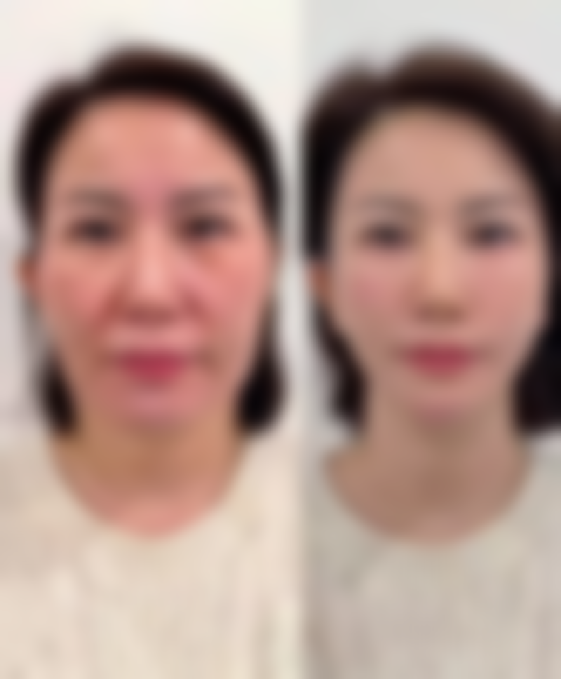 深圳仁安雅医疗美容门诊部怎么样，价格表情况