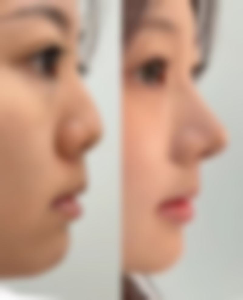 韩国Bustium整形外科怎么样，口碑好不好