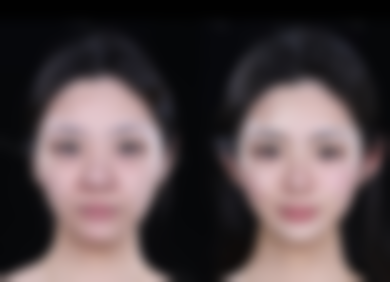 天津英瑞齿科（小白楼店）抖音团购活动及价格表