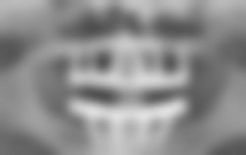 双眼皮割窄了加宽的费用受哪些因素影响