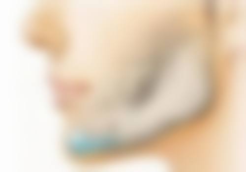 疤痕体质的人纹眉对身体的影响剖析