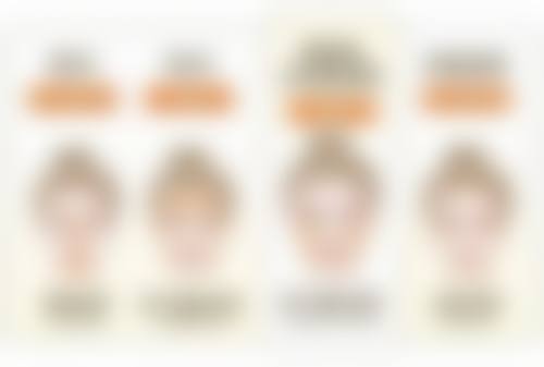 双眼皮割窄了加宽的修复时间要多久