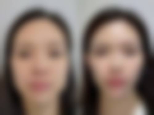 丹东新运医疗美容诊所价格表