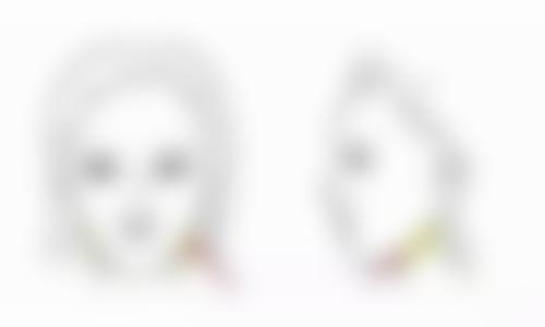 5大热门合资隆胸假体品牌深度剖析