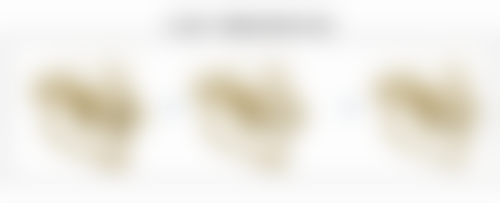 双眼皮割窄后加宽的至佳时机是什么时候