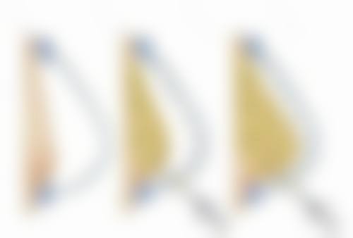 面部缝针陈旧性疤痕能去掉吗