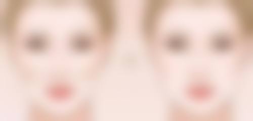 如果女人孕期有眼袋怎样祛除:准妈妈的特殊关怀