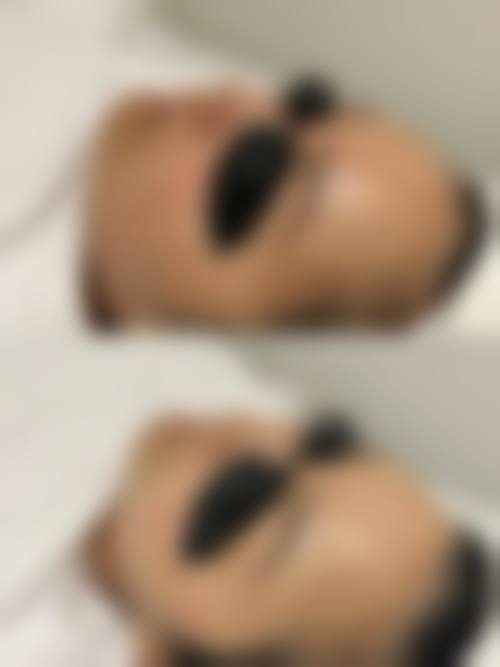 香港SWISS O Beauty Expert整形医院抖音团购活动有哪些，价格表