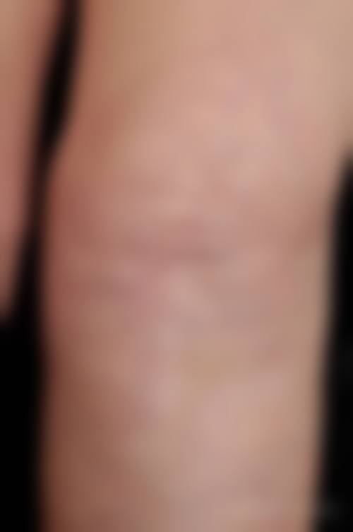 泸州医美花都医疗美容的抖音团购活动及价格表情况