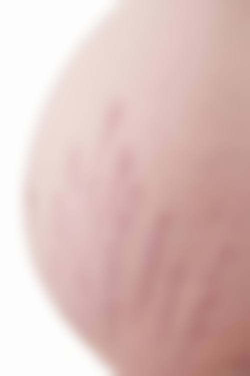 苏州婉美整形医疗美容诊所怎么样？可靠吗