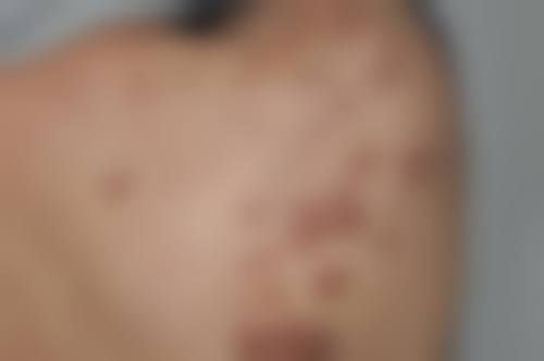 香港SWISS O Beauty Expert整形医院口碑好不好