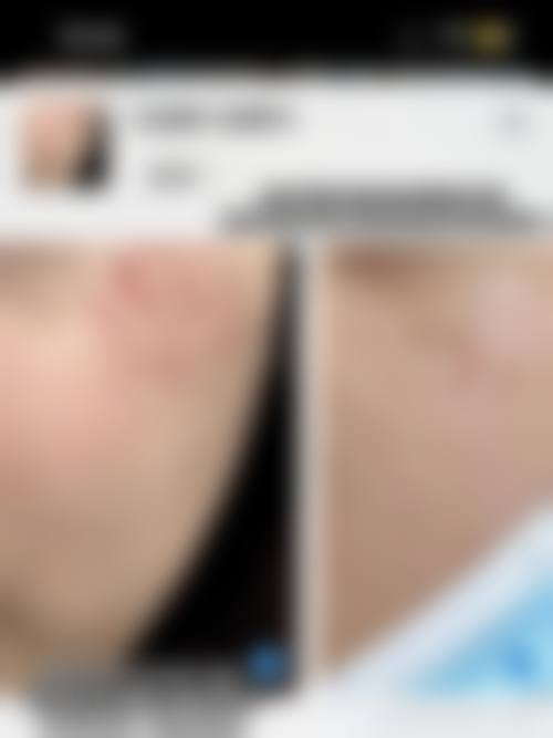 张家界瑞美整形医院怎么样——口碑评价