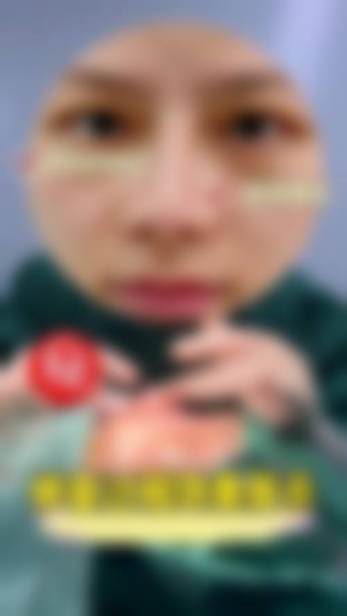 山东临沂郯城新益民医院口碑好不好