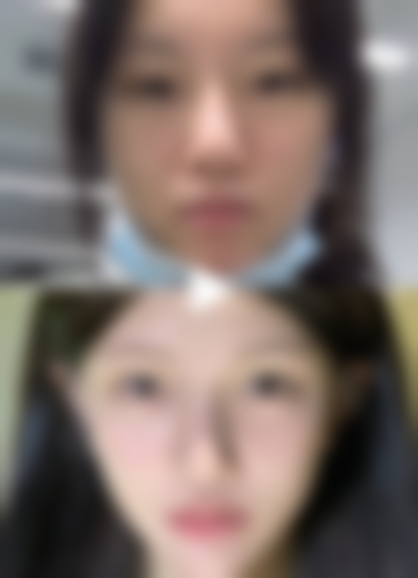 疤痕治疗的价格和医院选择