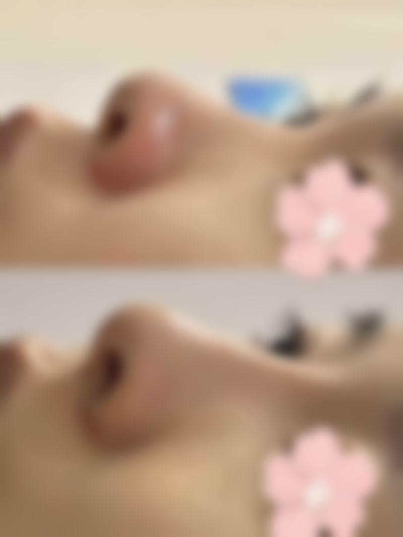 护理指南:给你的眼皮“做SPA”