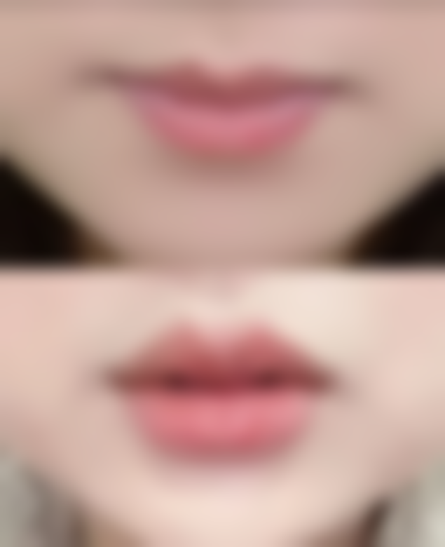 韩国Why口腔颌面外科抖音团购活动及价格表